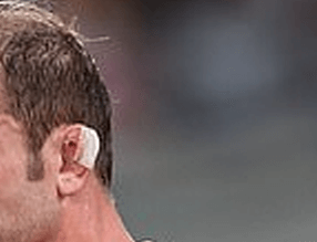headshot of player's ear with a small section of tape on the top of ear